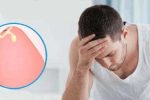 Dương vật chảy mủ 90% bạn đã mắc bệnh lậu