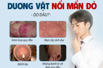 Đầu dương vật nổi mẩn đỏ ngứa – Cảnh giác 8 bệnh nguy hiểm