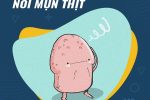 [Cảnh báo] Dương vật nổi mụn thịt dấu hiệu bệnh lý nguy hiểm