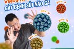 [Hé lộ] 5+ Biểu hiện dễ thấy của sùi mào gà mà ai cũng nên lưu ý