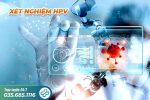 Tại sao nên xét nghiệm bệnh xã hội?