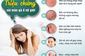 Sùi mào gà ở nữ giới nguy hiểm như thế nào? Cách điều trị hiệu quả