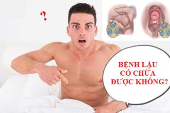 Bệnh lậu có chữa được không? Giải đáp từ chuyên gia nam khoa