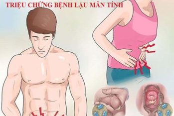 Bệnh lậu giai đoạn mãn tính – Triệu chứng âm thầm, hậu quả dai dẳng