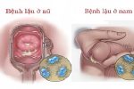 Chủ quan với bệnh lậu – Sai lầm khiến nhiều người hối hận quá muộn