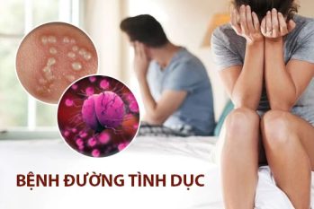 Điểm danh các bệnh đường tình dục nguy hiểm phổ biến hiện nay