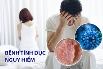 Top những bệnh tình dục nguy hiểm lây nhanh và khó nhận biết