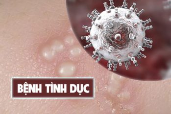 Khám bệnh tình dục ở đâu uy tín, an toàn tại TP.HCM?
