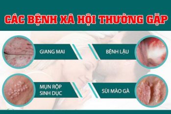 Xem ngay! Hình ảnh bệnh xã hội ở nam và nữ dễ nhận biết hiện nay