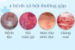 Tổng hợp một số bệnh hoa liễu nguy hiểm thường gặp ở nam và nữ giới