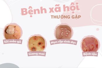 Cảnh báo những bệnh xã hội nguy hiểm, dễ mắc phải nhưng thường bị bỏ qua