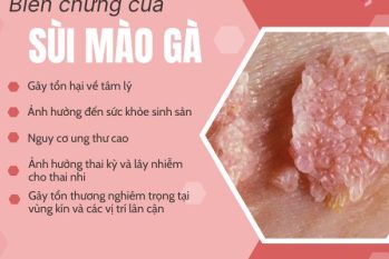 Đừng chủ quan! Biến chứng sùi mào gà có thể để lại hậu quả kéo dài