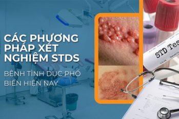 Xét nghiệm STDs là gì? Những dấu hiệu cảnh báo bạn cần đi kiểm tra ngay