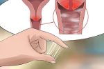 Âm đạo chảy mủ là biểu hiện của bệnh gì? Có nguy hiểm không?