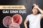 Mụn cóc sinh dục ở nam và nữ giới – Đừng chủ quan với những nốt mụn nhỏ ở vùng kín