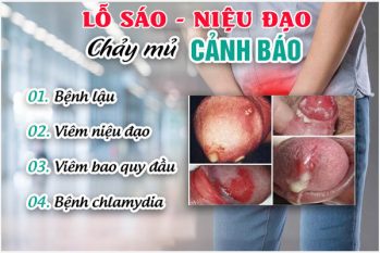Niệu đạo chảy mủ là bị gì? Có sao không?