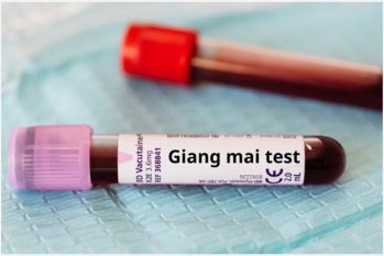 Xét nghiệm giang mai cách phát hiện bệnh sớm và chính xác